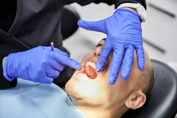 Best Emergency Root Canal Treatment in Oneida, TN